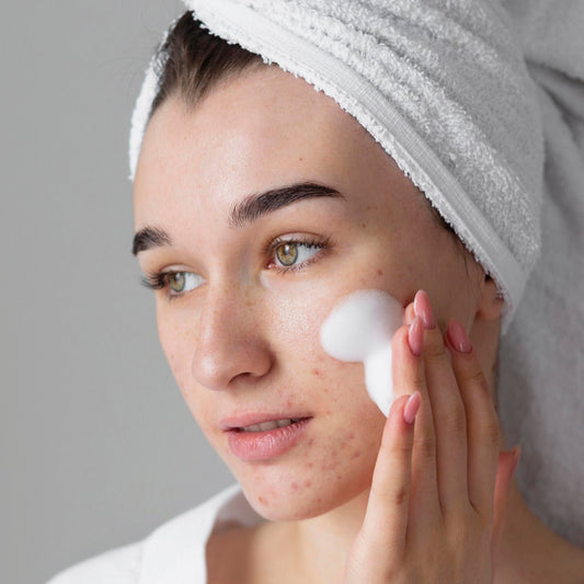 Acne Care Collection Box - 195 ml