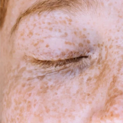 Vitamin C Serum - 30 ml