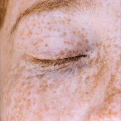 Hautton Korrektor, mit 1% Kojic Säure - 15 ml