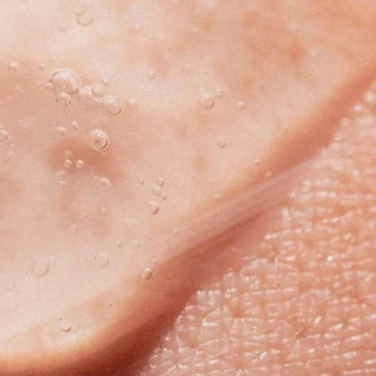 Acne Care Collection Box - 195 ml